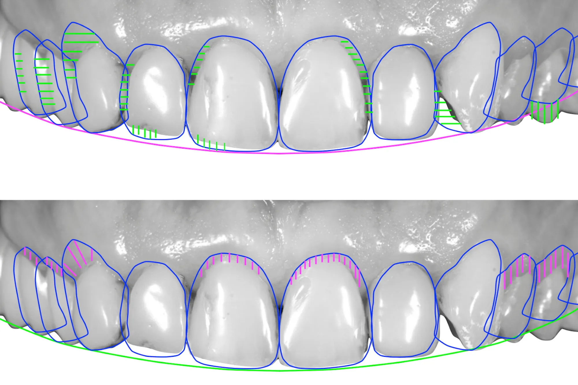 smile design casablanca